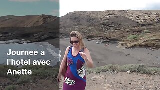 Թմբլիկ կիսանդրի ուսա ...